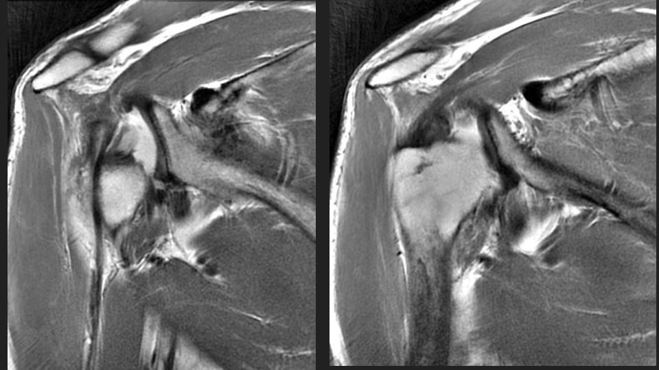 Figure 4 for case dislocation ( RID4770 )